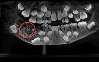 阴牙齿电影在线观看,惊悚悬疑，揭秘恐怖真相